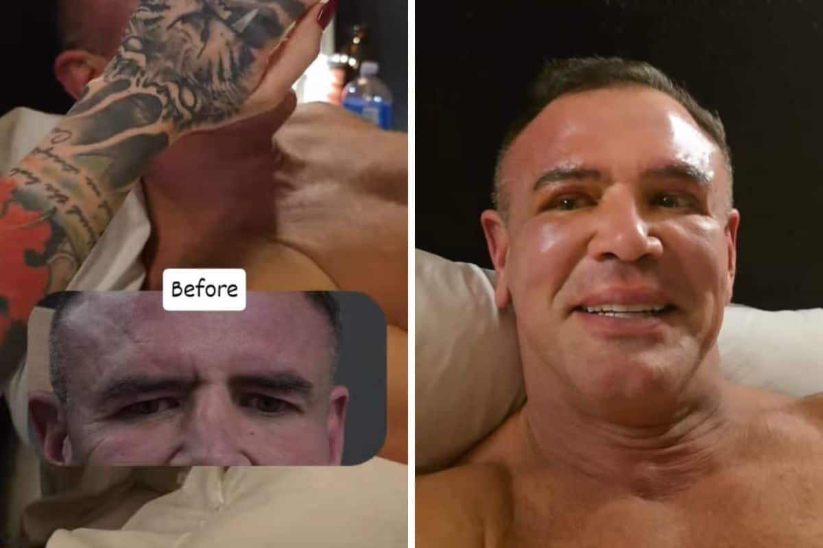 ‘Boo Bear’ Calven Robinson undergoes cosmetic eyebrow surgery - South ...
